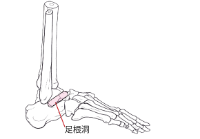 足根洞の位置を解説するための図